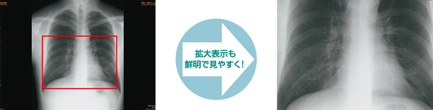 病気の発見も容易に。